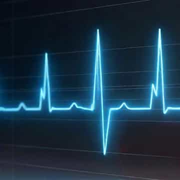 EKG_ECG_Monitor_Screen_360x360_Q50