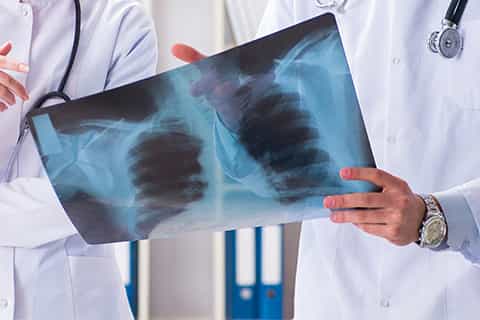 Two_doctors_Examining_X-ray_480x320_Q50